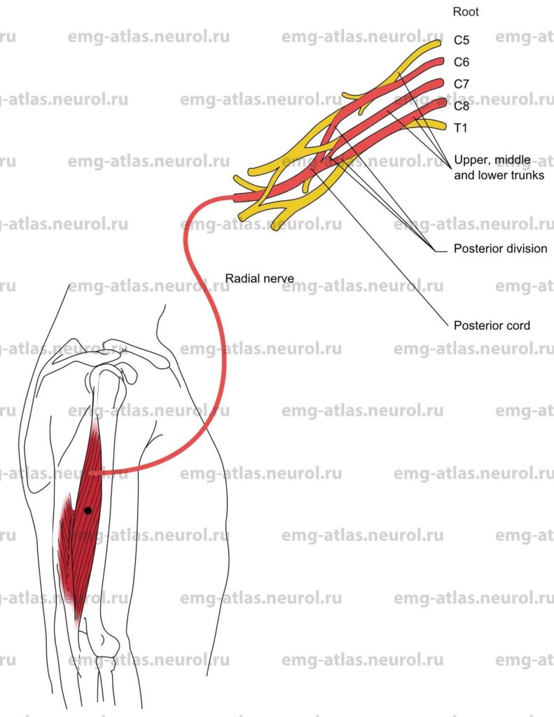 Triceps, Lateral Head