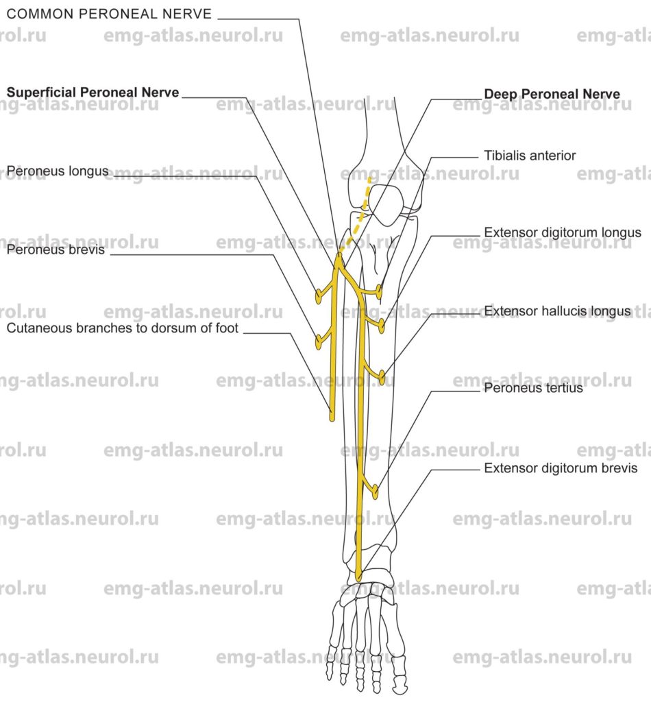 Common Peroneal Nerve