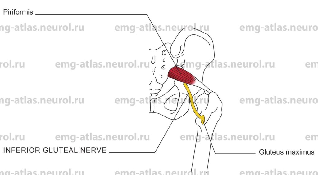 Inferior Gluteal Nerve